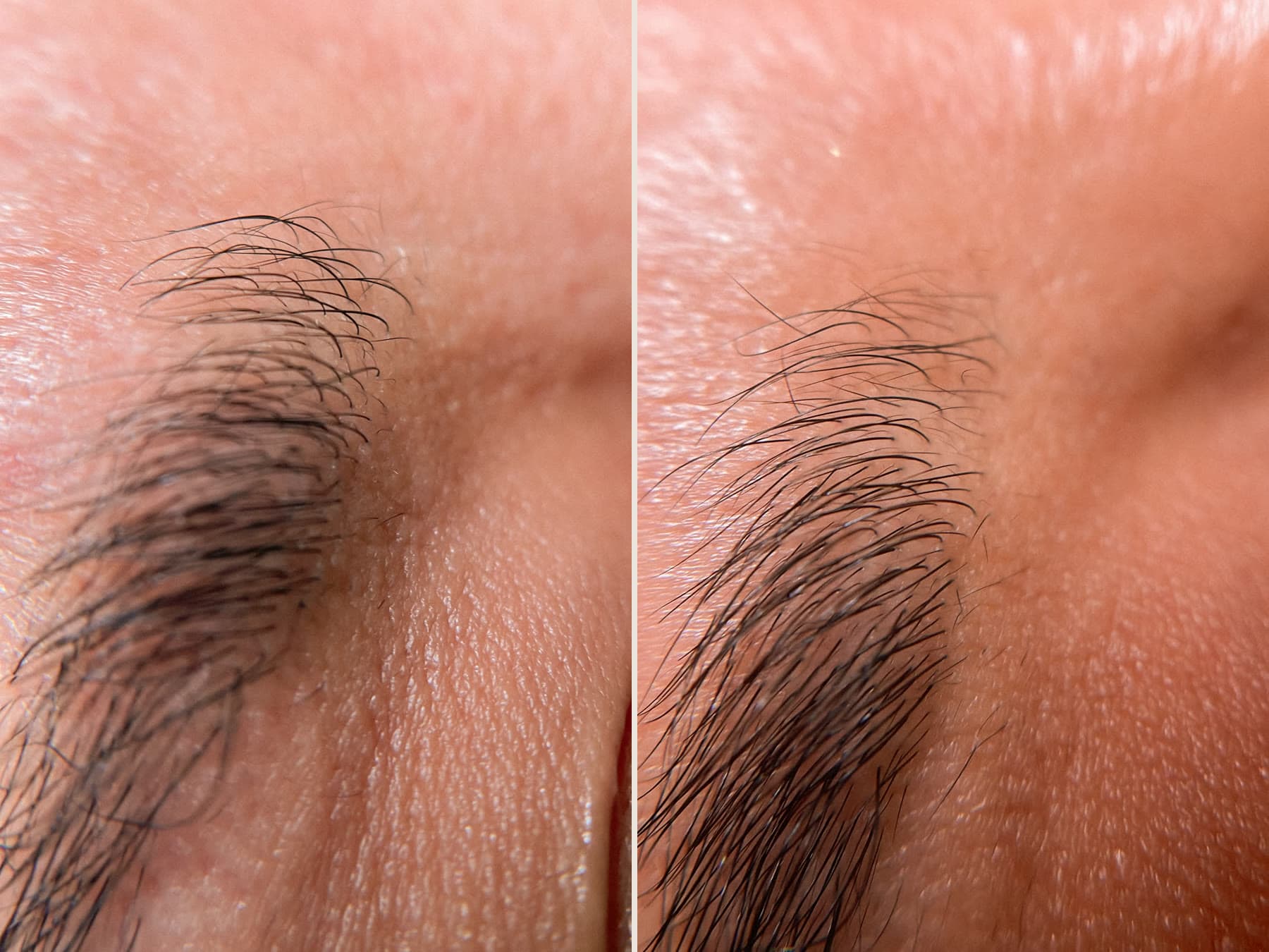 Grow Brows